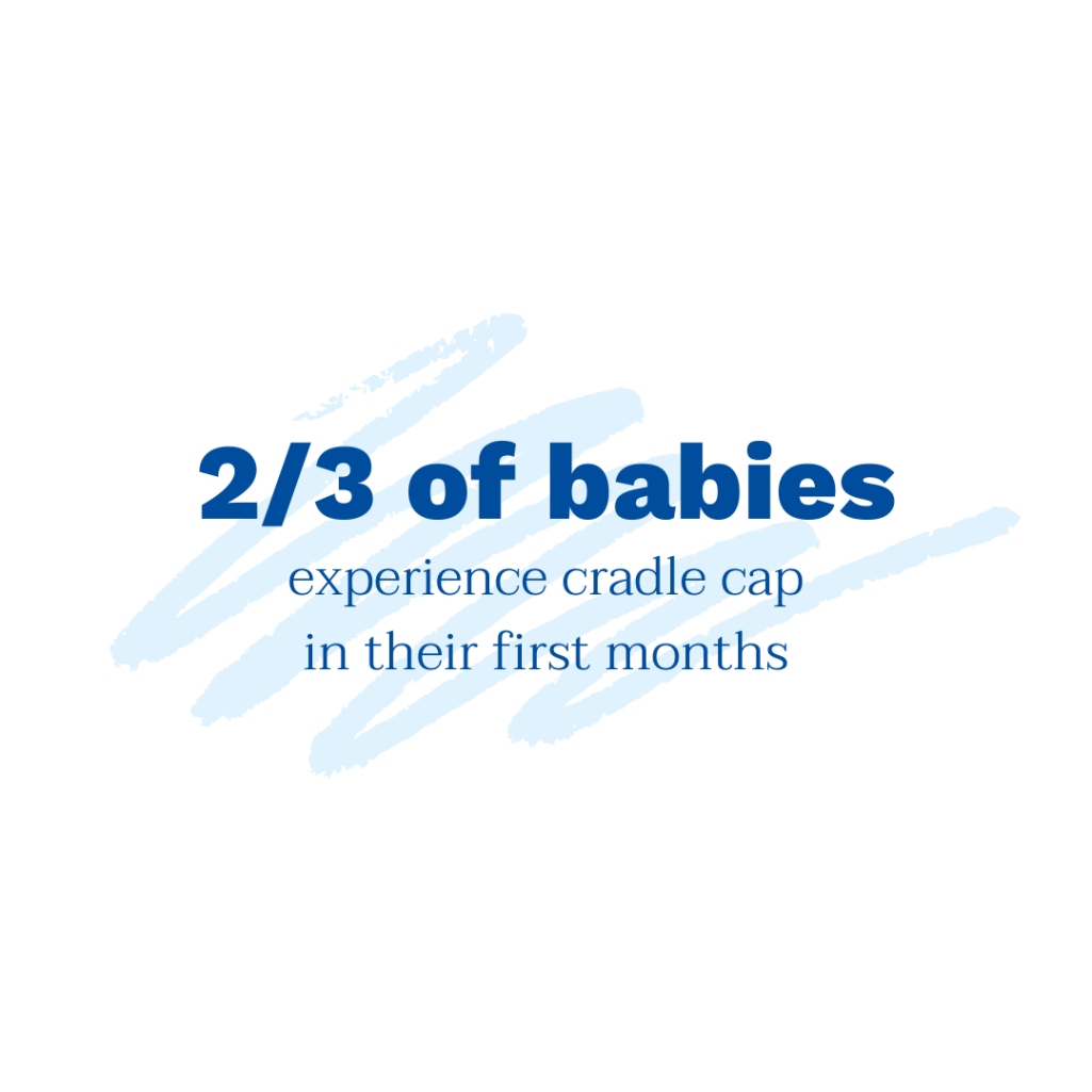 2/3 of babies experience cradle cap in their first months