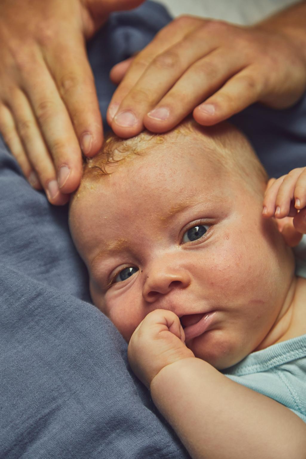 Massage-baby-scalp